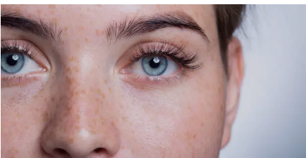 LASIK eye surgery